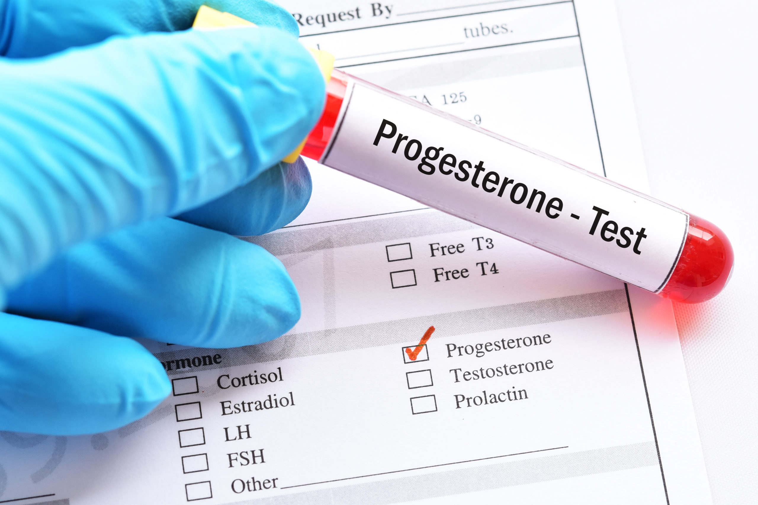 Progress with Progesterone