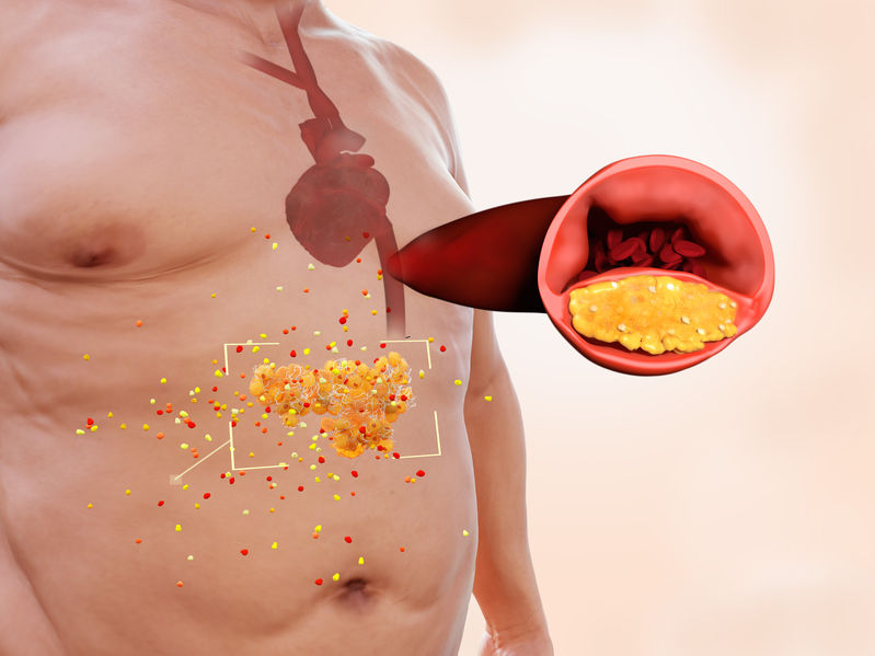 Belly fat is more than just an aesthetic problem