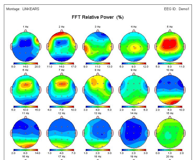 How a qEEG session can change your life